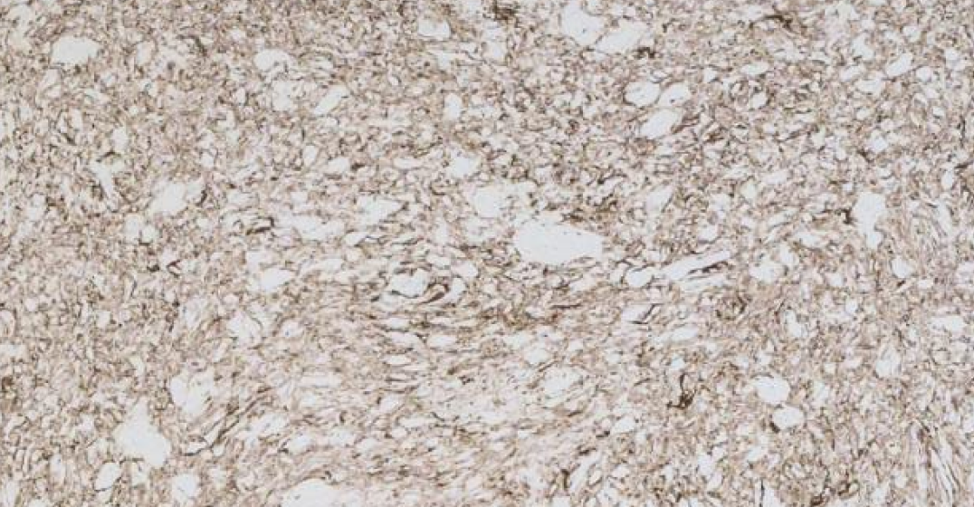 Carrara White Marble